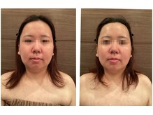 ココ 広島店(COCO)/ララピール　ビッフォーアフター