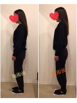 うちんだい整骨院 整体院/20代女性/骨盤矯正 施術事例