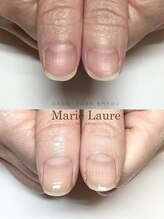 マリーロール 淀屋橋本店(Marie Laure)/自爪育成/深爪矯正/ネイルケア