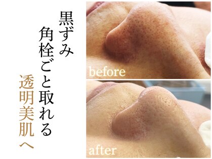 ソイズ 新保店(SOIS)の写真
