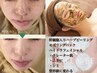 【人気No1★幹細胞入り/本格肌改善】ハーブピーリング×ハイドラ毛穴洗浄