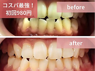 【新品未使用】 BODY ARCHI ボディアーキナイトスパッツM BODY ARCHI ボディアーキ ナイトスパッツ Body Archi ボディアーキ