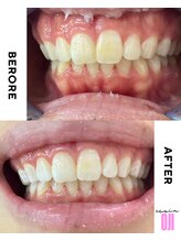 エクシアホワイトニング 王寺店/