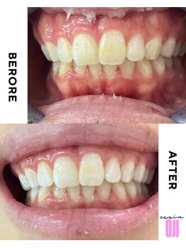 エクシアホワイトニング 王寺店/