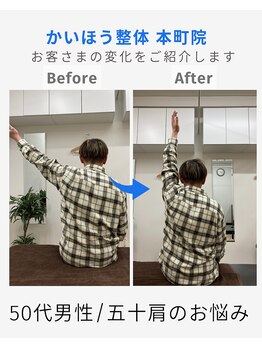 かいほう整体 本町院/痛くて上がらない腕