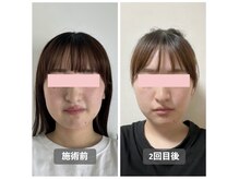 シー 下北沢(sea)の雰囲気(顔の大きさ余白◇エラ◇左右左◇歪み◇たるみ◇Vライン形成◇)