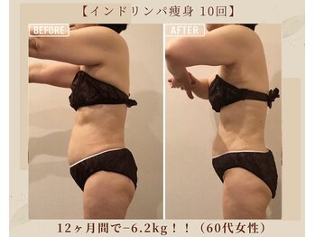 オキシー グレイス 小倉店(OXY Grace)/インドリンパ痩身xキャビ