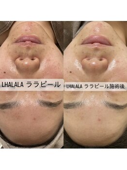 グラン ジュテ/LHALALA &nbsp;ララピール