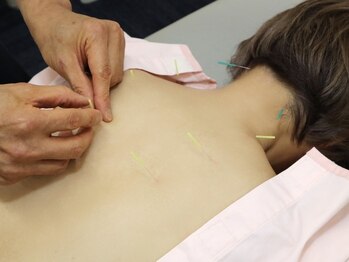 弘泉堂鍼灸接骨院の写真/《鍼灸の効果は無限大》手技では届きにくい血流の深い滞りまで優しくアプローチ◎肩首凝り/腰痛/むくみ改善