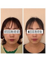 キュープ 静岡店(Qpu) 人気No.2 オイル
