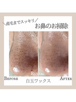 ルシアル(Rucial)/白玉ワックスで毛穴まで綺麗♪