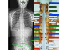 オレンジカイロプラクティックの雰囲気（科学的根拠を重要視。骨盤や背骨の状態を少し違う視点から見ます）