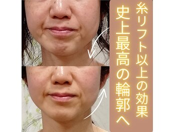 目元 口元のたるみ 眉間シワ改善専門サロン
