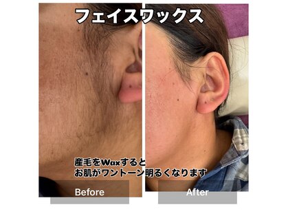 カロス(Calos)の写真