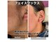 カロス(Calos)の写真