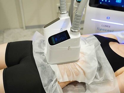 ルナ(LUNA)の写真