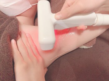 アンシャンテ 神戸元町店(Enchante)の写真/《結果重視》全身脱毛や部位ごとの脱毛も◎最先端脱毛で特許取得!美肌効果も抜群♪黒ずみケアまで★