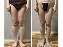 スリーピングビューティー(Sleeping Beauty)/