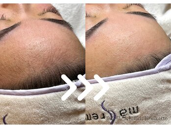 ニカット(nikatto)/フェイシャルワックスビフォアフ