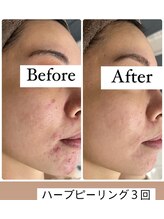 エルア 尼崎(Elua)/