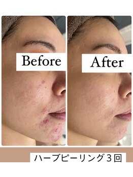 エルア 尼崎(Elua)/