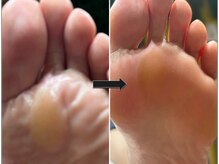 ウォーク(Walk)の雰囲気（足裏の悩み/爪の悩み／ドイツ式特殊施術で快適な足へと改善!!）