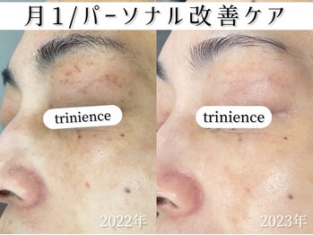 トリニエンス 新宿店(TRINIENCE)/40代/シミケア/パーソナルケア