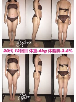 シェイプ 浜松本店/姿勢矯正大成功