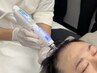 男性の幹細胞頭皮エイジングケア＊ボリュームや頭皮の改善¥55,000⇒¥27,500
