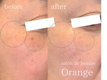 サロンドボーテ オランジュ(salon de beaute Orange)