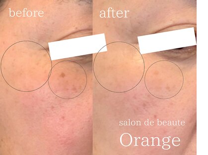 サロンドボーテ オランジュ(salon de beaute Orange)の写真