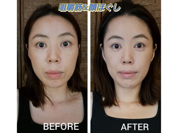 頭のマッサージ屋さん 神楽坂/咀嚼筋ほぐし/顔ほぐし