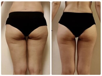 ディオ(Dio)/キュッとヒップアップ！