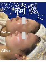 リヴィア(LIVIA)/より綺麗な綺麗な水光肌へ！