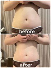 リムアール(Limh R)/