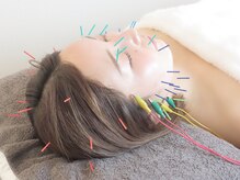 バスト鍼ラボ 代々木上原(BUST 鍼LAB.)/美容鍼