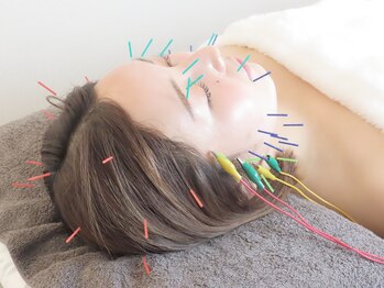 バスト鍼ラボ 代々木上原(BUST 鍼LAB.)/美容鍼