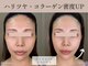 イヴジュ サロン(YVESJU SALON)の写真/たるみが気になる方へ。顔もバストも同時にケア♪ ハリツヤあふれる引き締まった印象の素肌へ◎