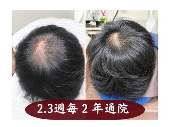 セントラル鍼灸院リラクシー(Re:laxy)の写真/四半世紀以上の経験と知識・原因を個別解析！マンツーマンだから相談しやすい。新メニューショートコース