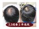 セントラル鍼灸院リラクシー(Re:laxy)の写真/四半世紀以上の経験と知識・原因を個別解析！マンツーマンだから相談しやすい。新メニューショートコース