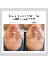 ポムハヌル(pom.haneul)/韓国肌管理室