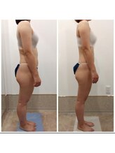 アイディエム 新宿店(IDM)/【モニター】150ｃｍ・20代