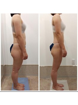 アイディエム 新宿店(IDM)/【モニター】150ｃｍ・20代