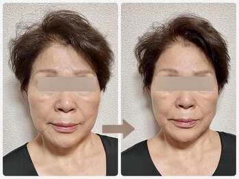 哲心 姫路/鏡を見て驚きました♪