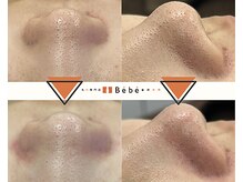 ベベ 金沢片町店(Be’be’)の雰囲気（1度でこの変化。ぜひビフォーアフターを実感して区ださい。）