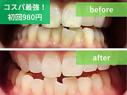 ボディアーキ 松山店(BODY ARCHI)の写真