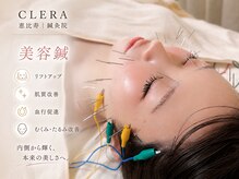 クレラ 恵比寿(CLERA)の雰囲気(小顔リリースリンパ×小顔矯正×美容鍼の施術が人気No.1です♪)