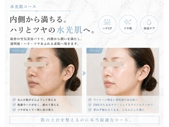 ウィラレア(UILALEA)の写真/【すっぴんを美しく】"美肌とリフトアップ"ダブルの継続力が自慢です◎一人一人に合わせたメニューをご提案