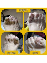 ドクターネイル爪革命 三郷店/ひこう爪ケア