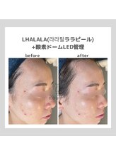 ポムハヌル(pom.haneul)/韓国肌管理室